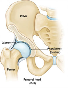 Rotura de Labrum