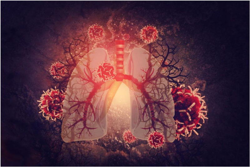 La grasa también se acumula en los pulmones