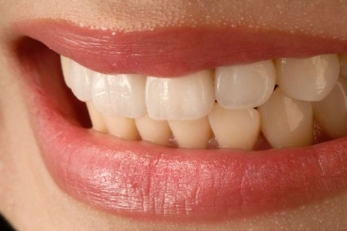 ¿Por qué duele la mandíbula?