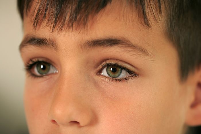 ¿Qué nos dicen las ojeras de los niños sobre su salud?