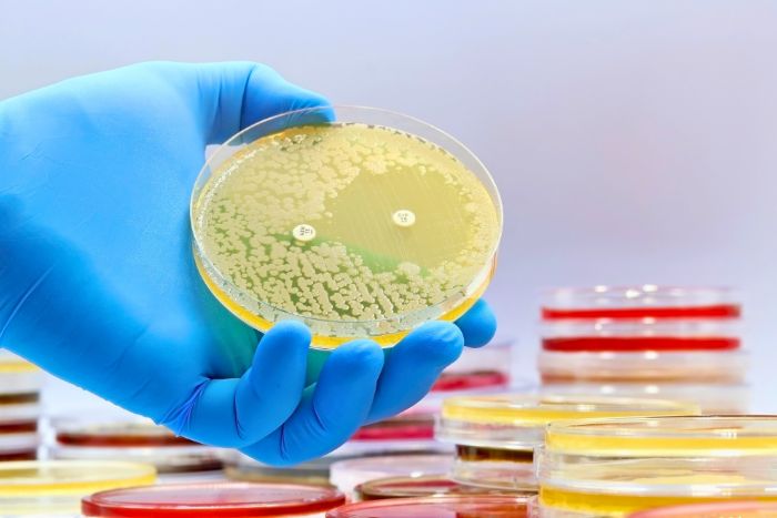 Prueba de cultivo de bacterias